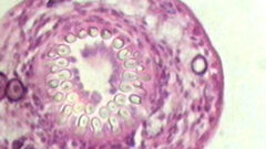 TGHN LAC invita a la tercera sesión del Club de Investigación en Hidatidosis
