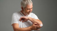 IGERO organiza su VI Webinar: «Tumores queratinocíticos en el adulto mayor»