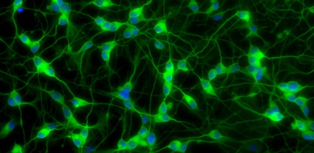 Foto para la publicidad