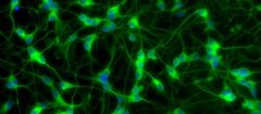 Taller de difusión de resultados: Identificación de proteínas larvales de Taenia solium asociadas al daño neuronal